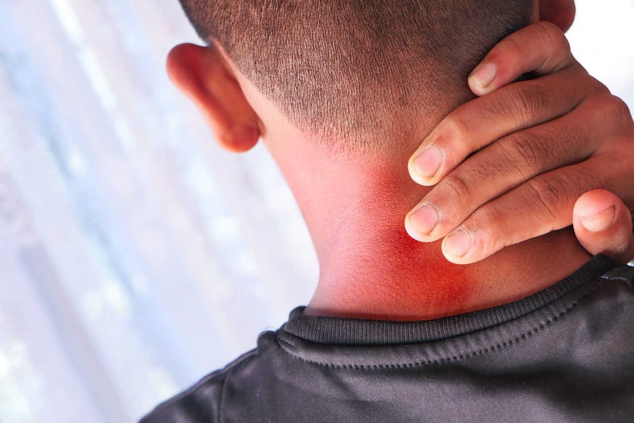 A man's hand on his neck showing skin redness.